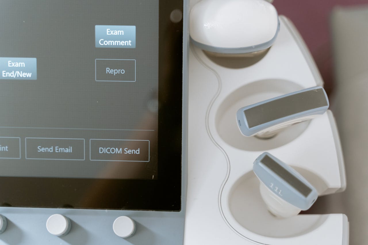 Close-up image of ultrasound equipment showing the monitor and probe holders.